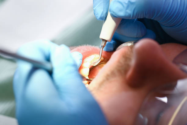Best Holiday Emergency Dentist in Conroe, TX
