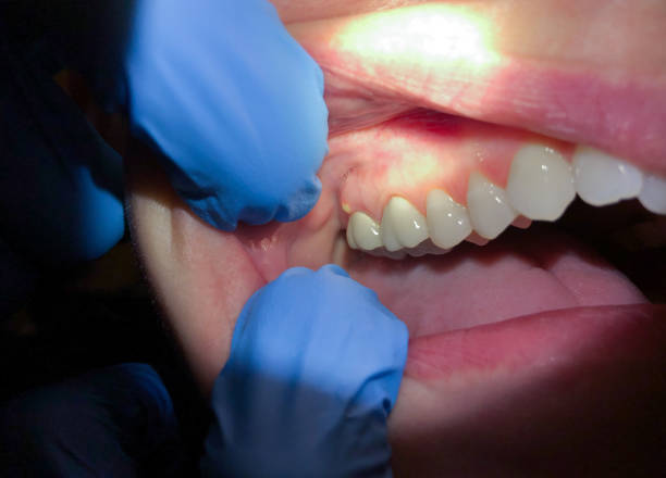Best Emergency Dental Services for Seniors in Conroe, TX