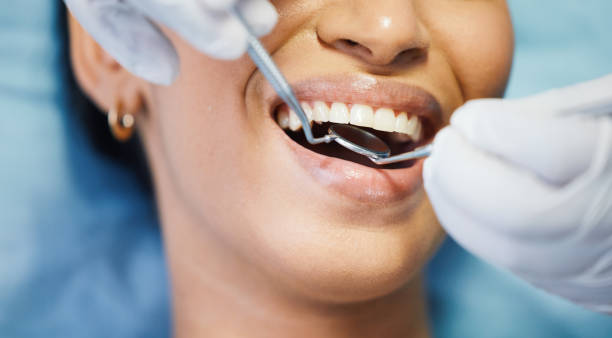Best Emergency Dentist for Lost Fillings or Crowns in Conroe, TX