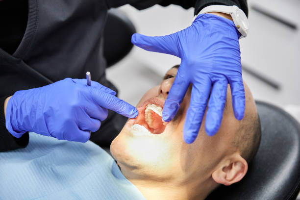 Best Emergency Dental Extractions in Conroe, TX