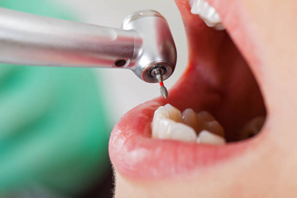 Best Pediatric Emergency Dentist in Conroe, TX